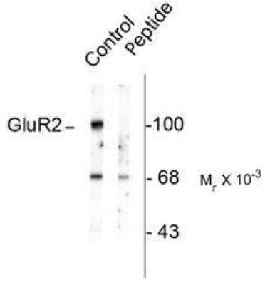 Western Blot: GluR2 [p Ser880] Antibody [NBP1-28662]